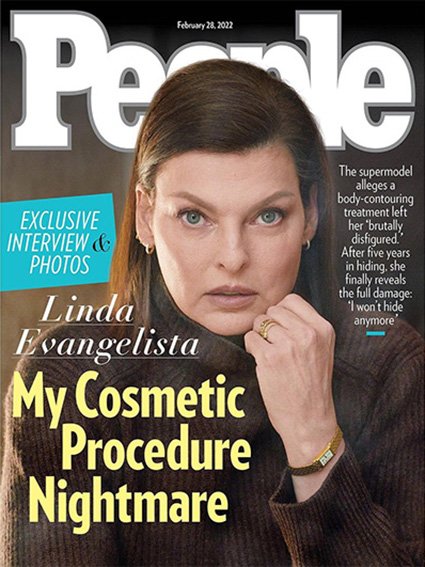 Линда Евангелиста рассказала журналу People о последствиях неудачной косметической процедуры