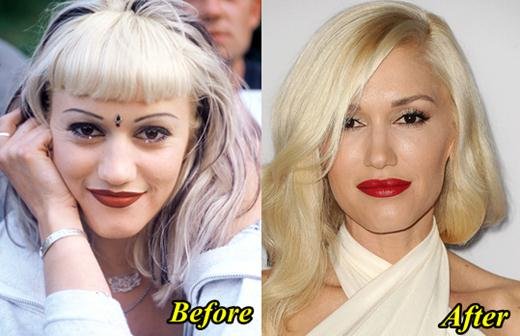 http://www.plasticsurgeryhits.com/wp-content/uploads/2014/11/Gwen-Stefani-Plastic-Surgery-Before-and-After.jpg